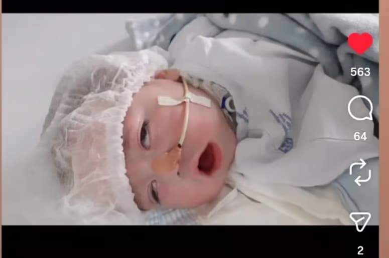 Bebe sofreu parada cardiaca com 1 mes de vida e voltou; agora luta por tratamento no Mexico que pode reduzir as sequelas