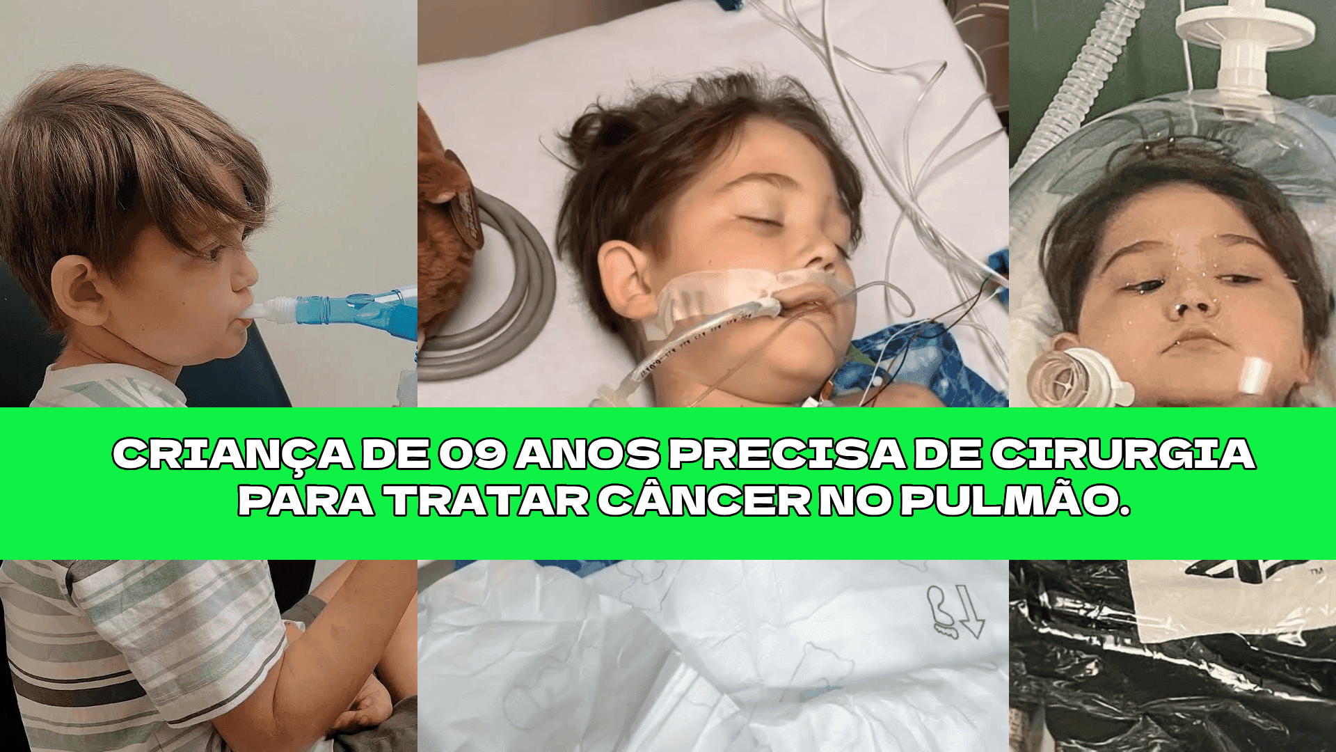 Crianca com cancer no pulmao precisa de cirurgia urgente que vai ser feita fora do estado