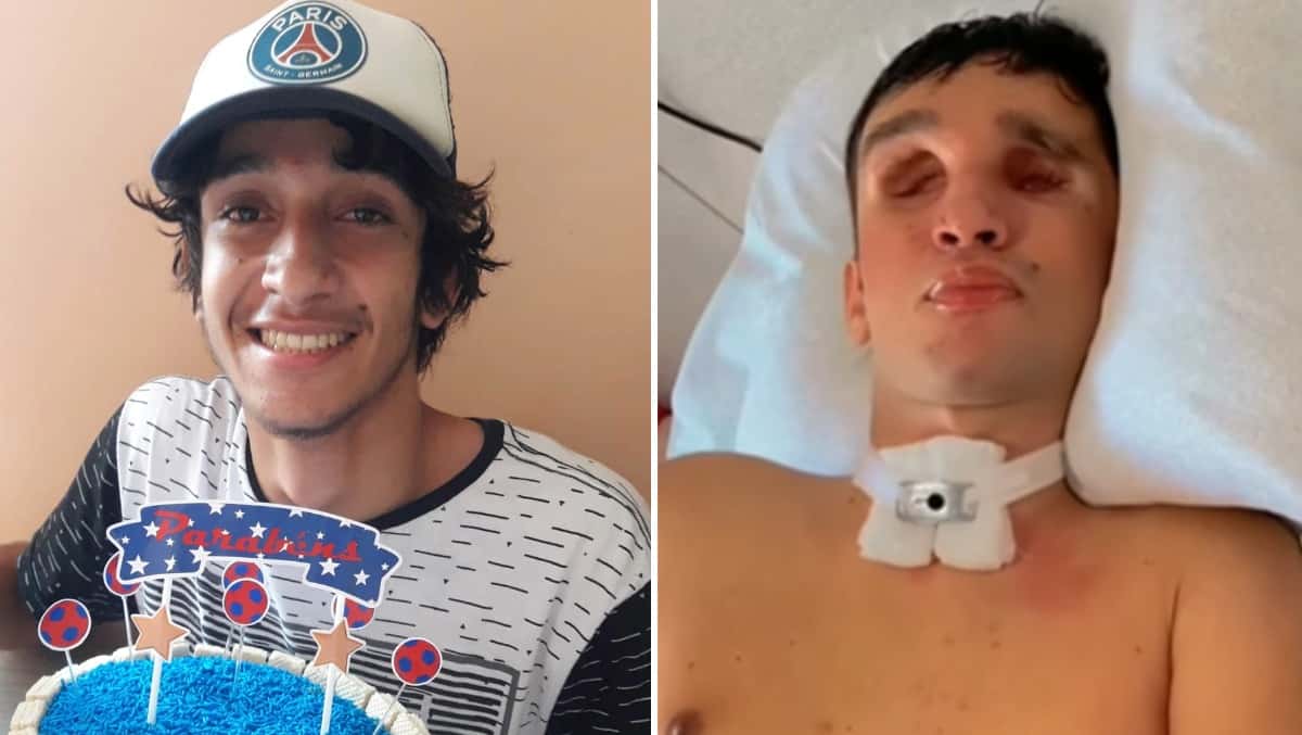 Vitima de bala perdida aos 19 anos, jovem perdeu os olhos e hoje vive acamado sob os cuidados da mae